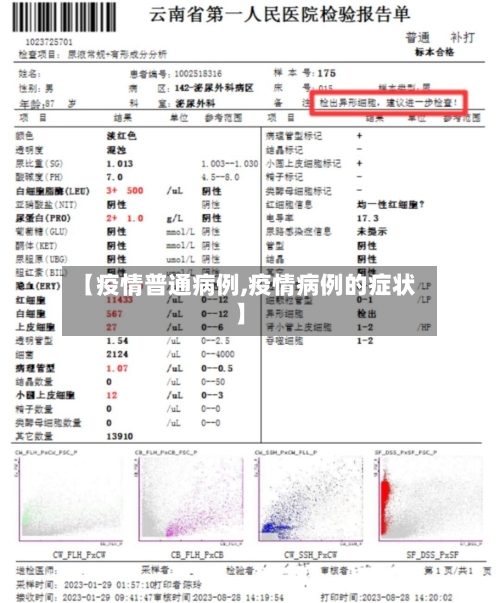 【疫情普通病例,疫情病例的症状】