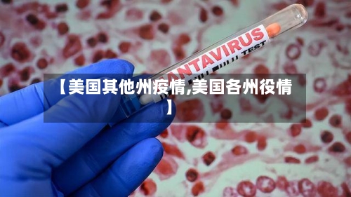 【美国其他州疫情,美国各州役情】
