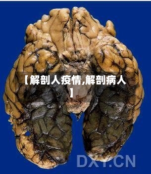 【解剖人疫情,解剖病人】