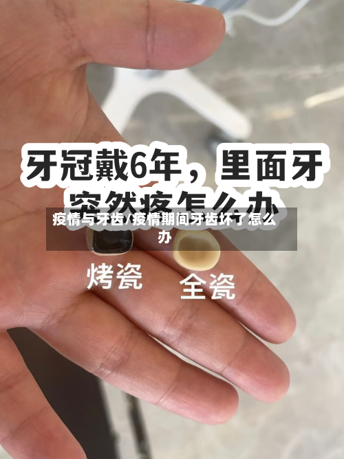 疫情与牙齿/疫情期间牙齿坏了怎么办