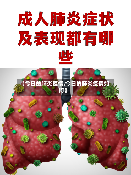 【今日的肺炎疫情,今日的肺炎疫情如何】