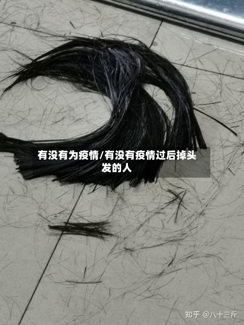 有没有为疫情/有没有疫情过后掉头发的人