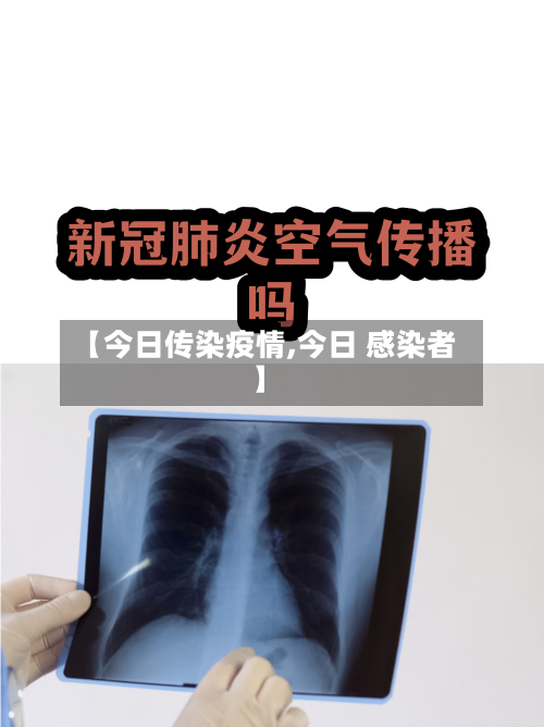 【今日传染疫情,今日 感染者】