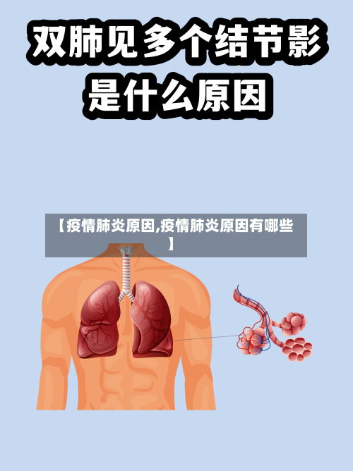 【疫情肺炎原因,疫情肺炎原因有哪些】-第3张图片