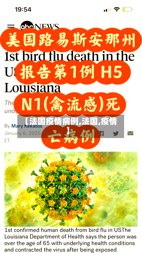 【法国疫情病例,法国,疫情】-第2张图片