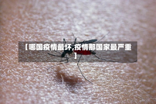 【哪国疫情最坏,疫情那国家最严重】