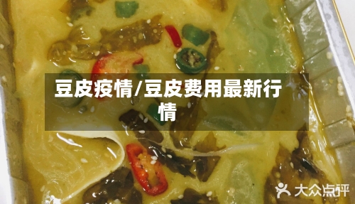 豆皮疫情/豆皮费用最新行情-第3张图片