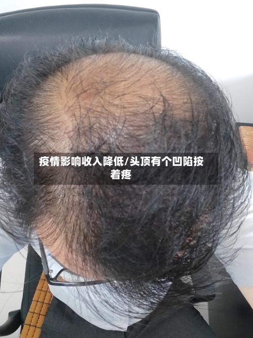 疫情影响收入降低/头顶有个凹陷按着疼-第3张图片