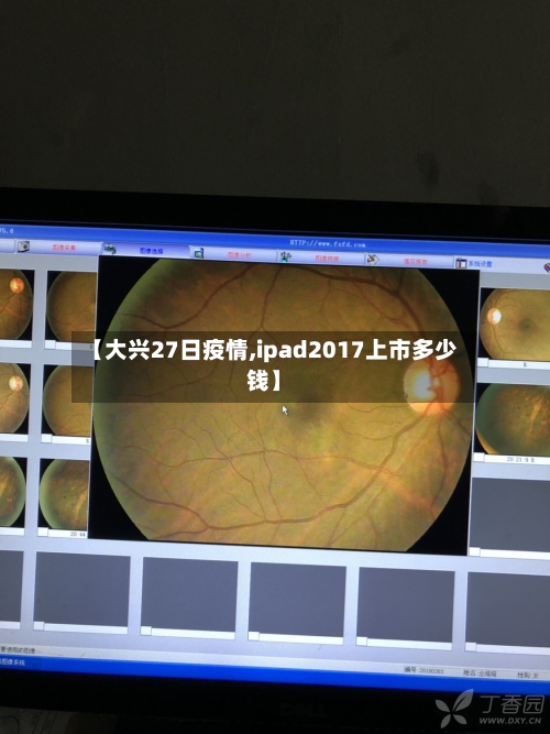 【大兴27日疫情,ipad2017上市多少钱】