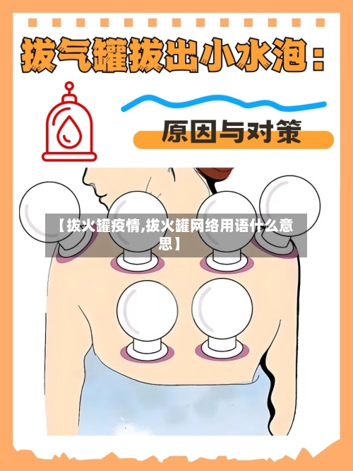 【拔火罐疫情,拔火罐网络用语什么意思】-第2张图片