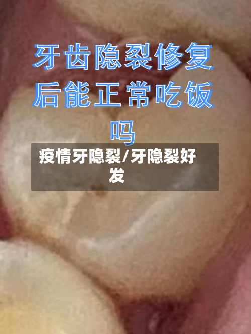 疫情牙隐裂/牙隐裂好发